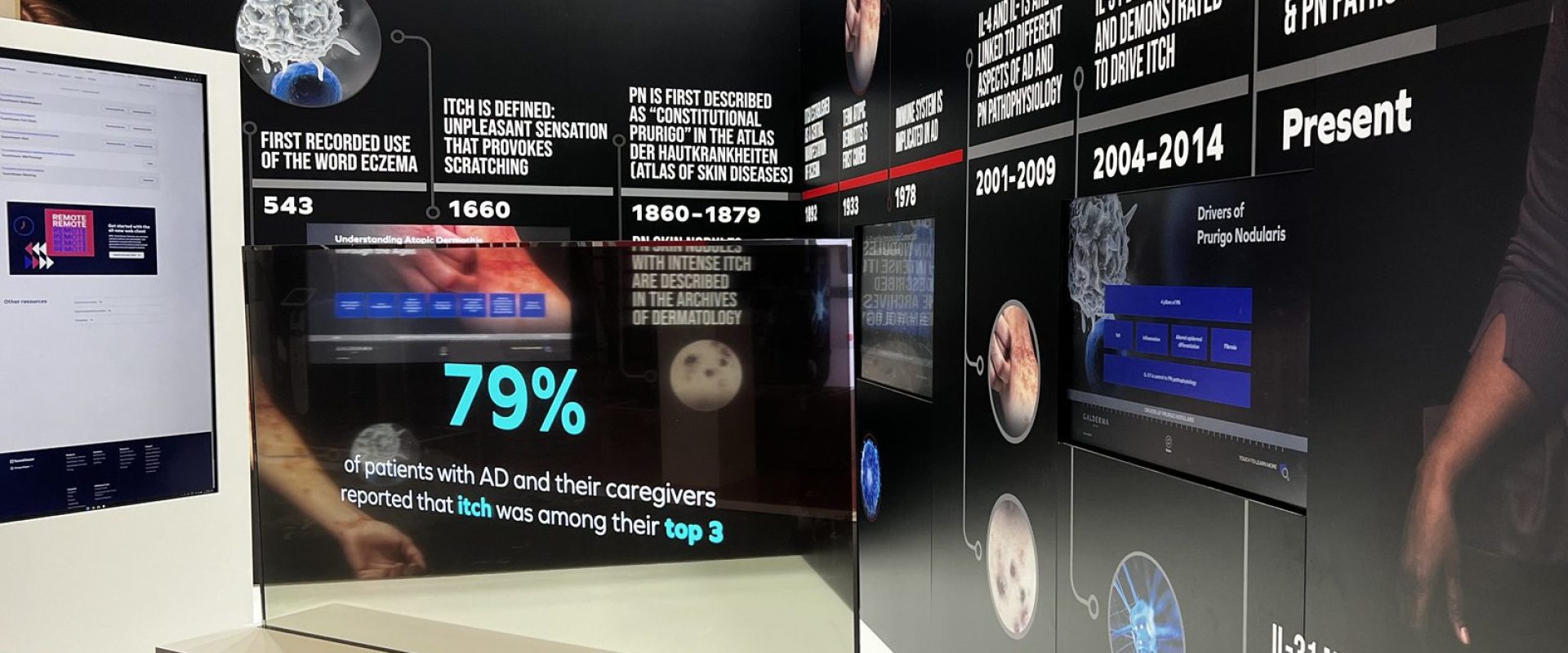 Hurricane_Galderma Berlin_LCD_obrazovky_dotykove_LED_transparentna OLED